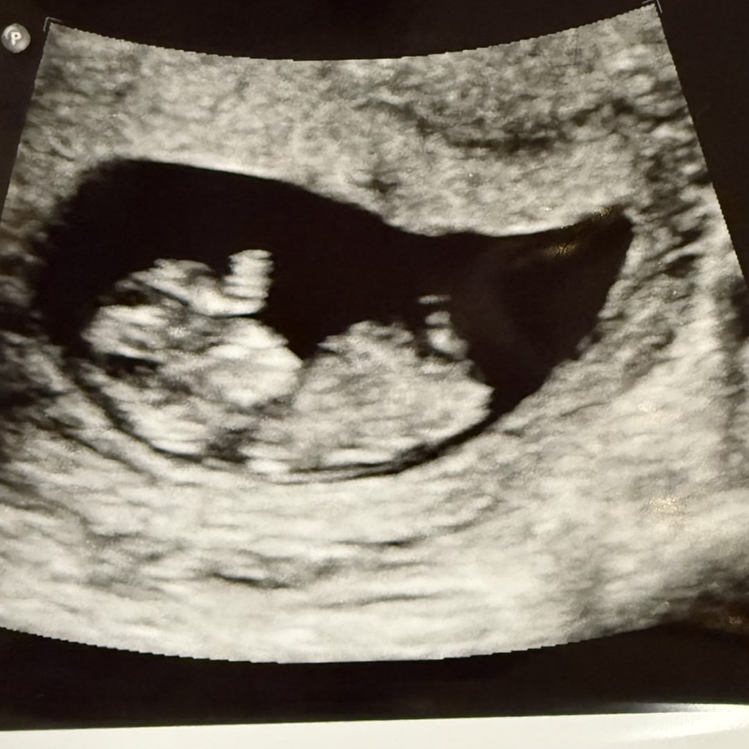 Photo shared by Ashley for their Babylist baby registry.