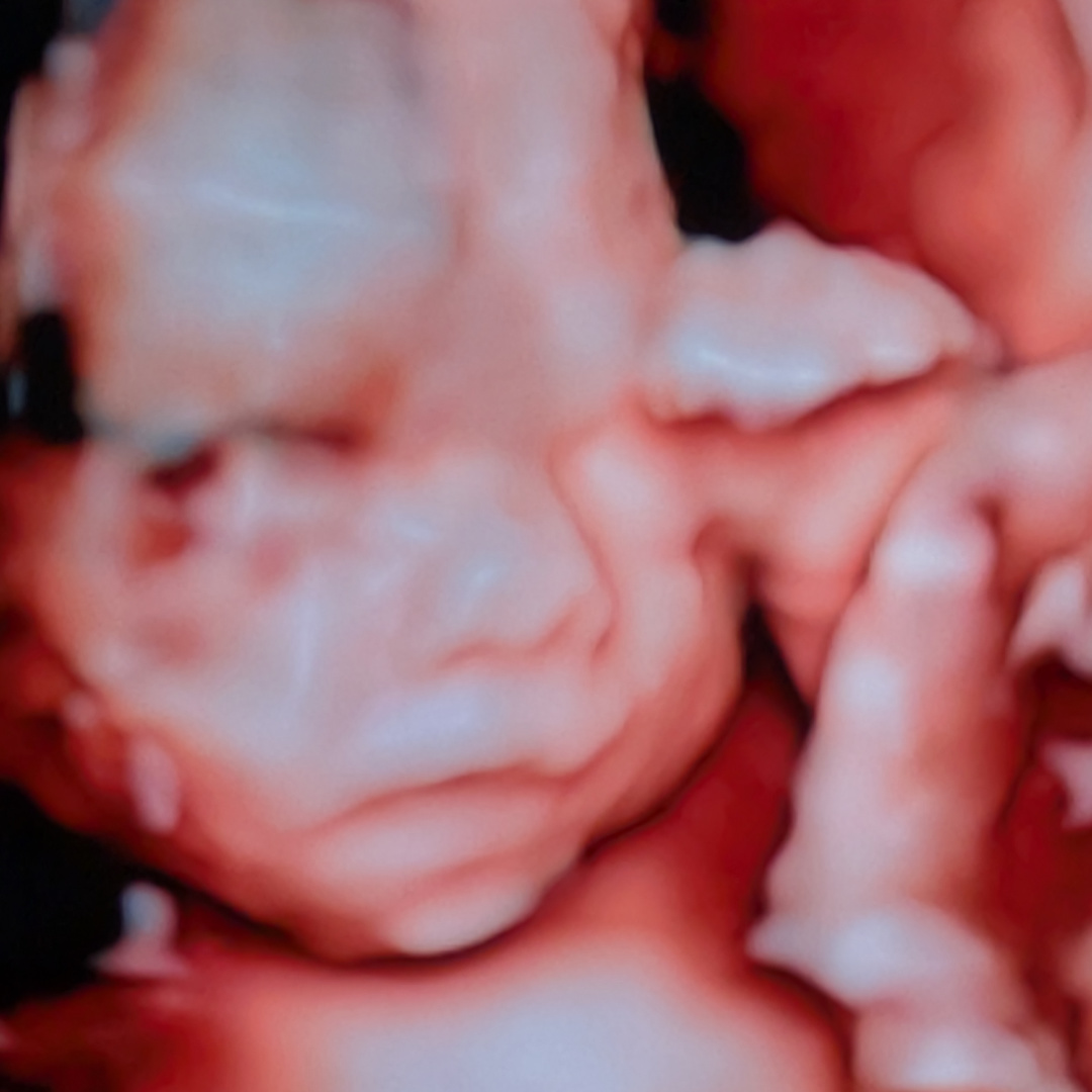 Photo shared by Katie for their Babylist baby registry.