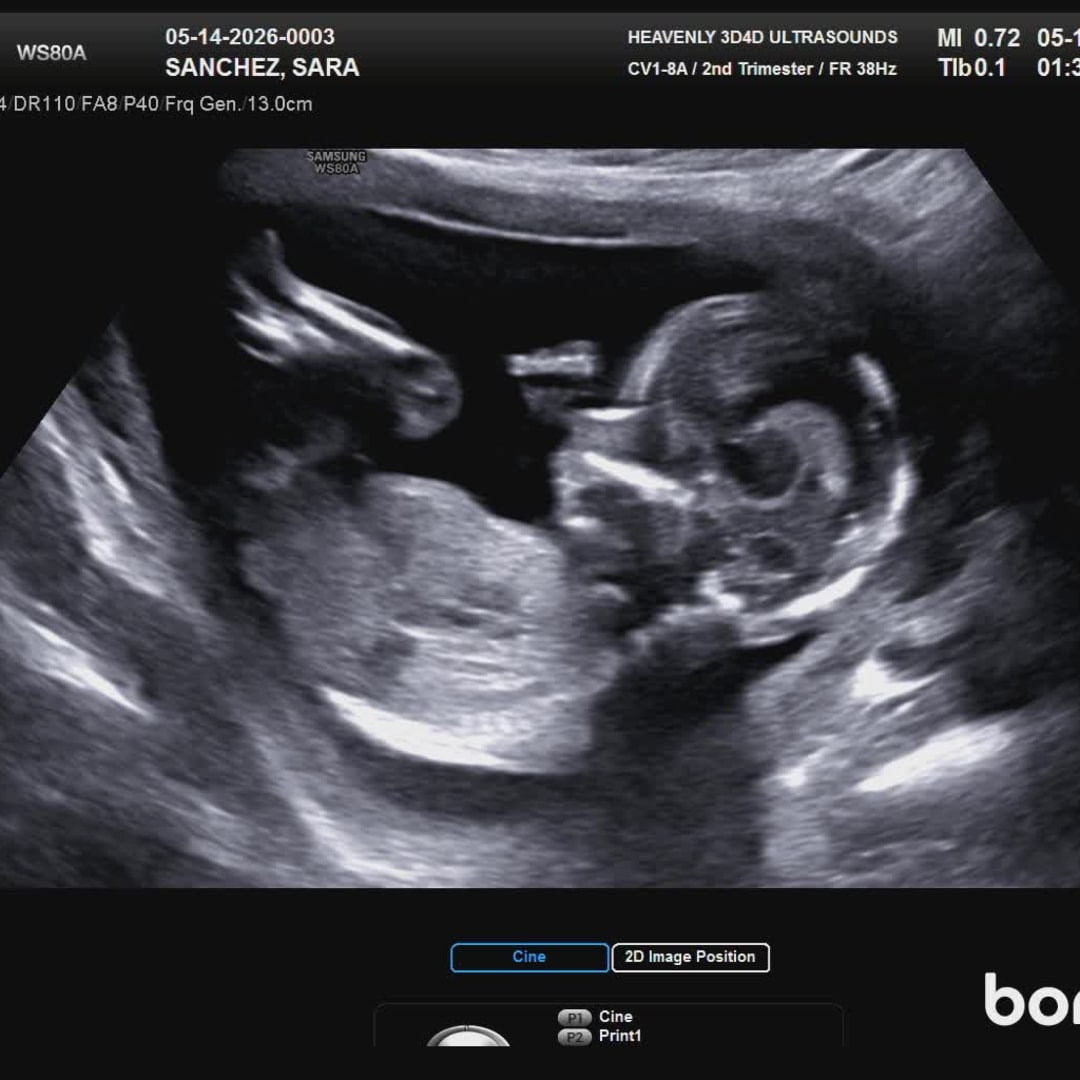 Photo shared by Sara for their Babylist baby registry.