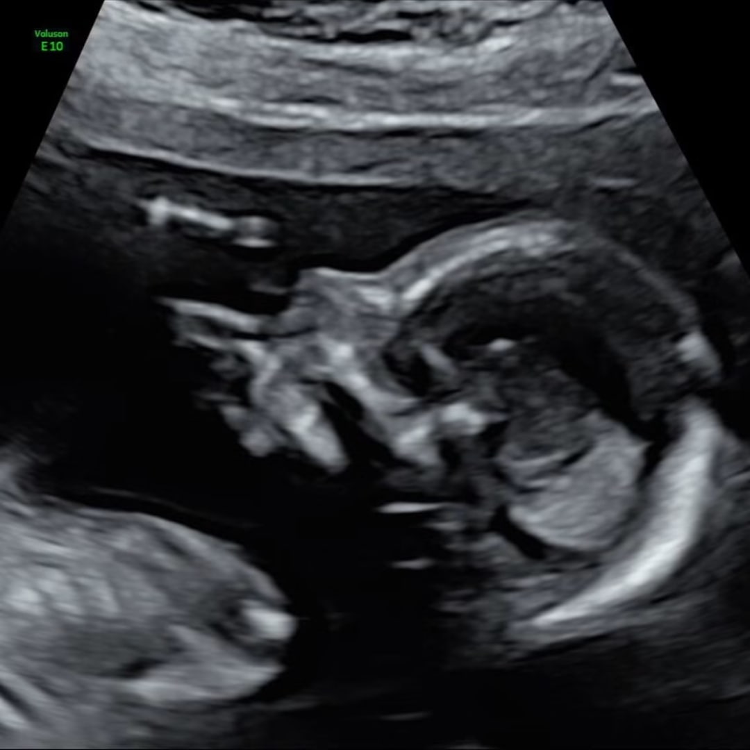 Photo shared by Jessica for their Babylist baby registry.