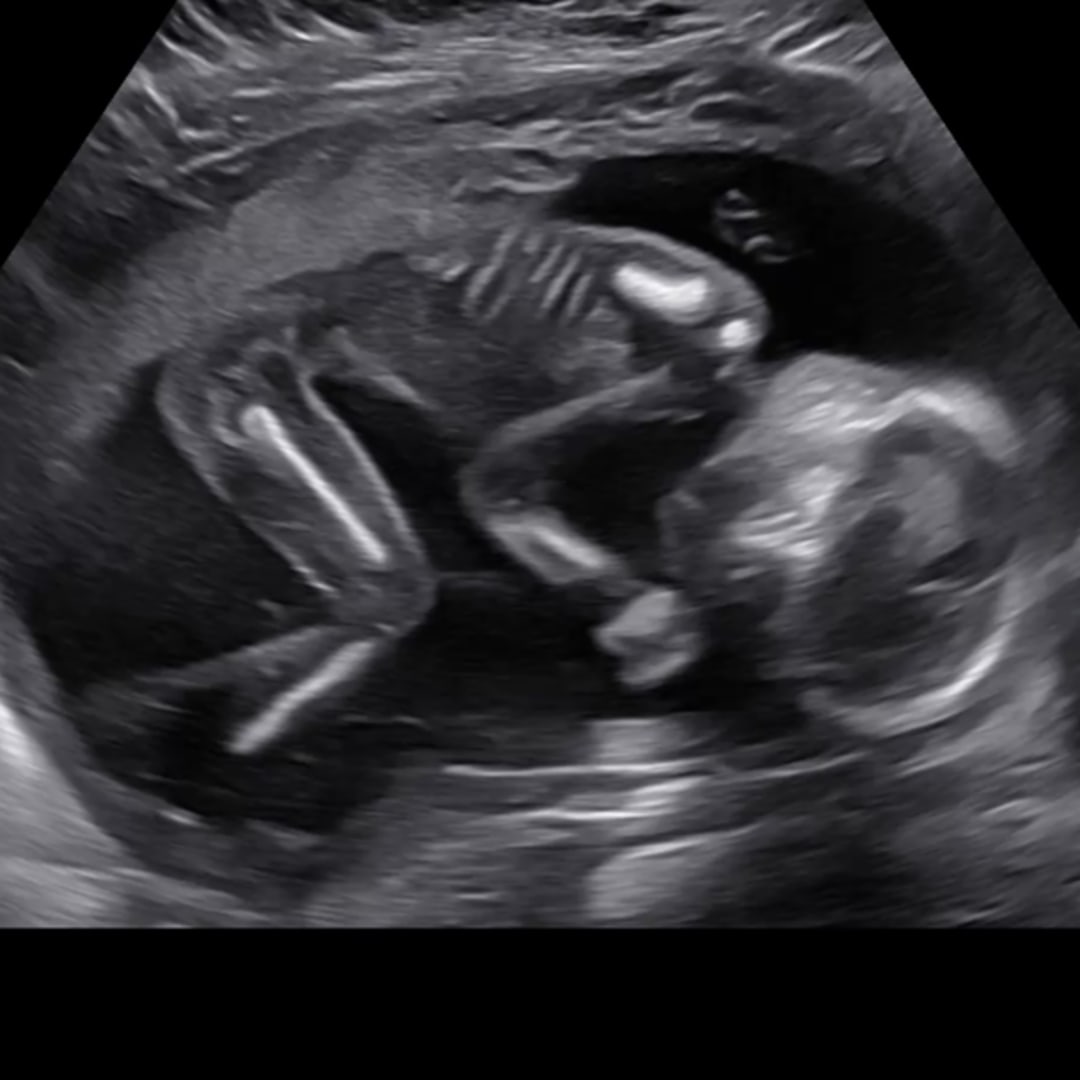 Photo shared by Kellie for their Babylist baby registry.
