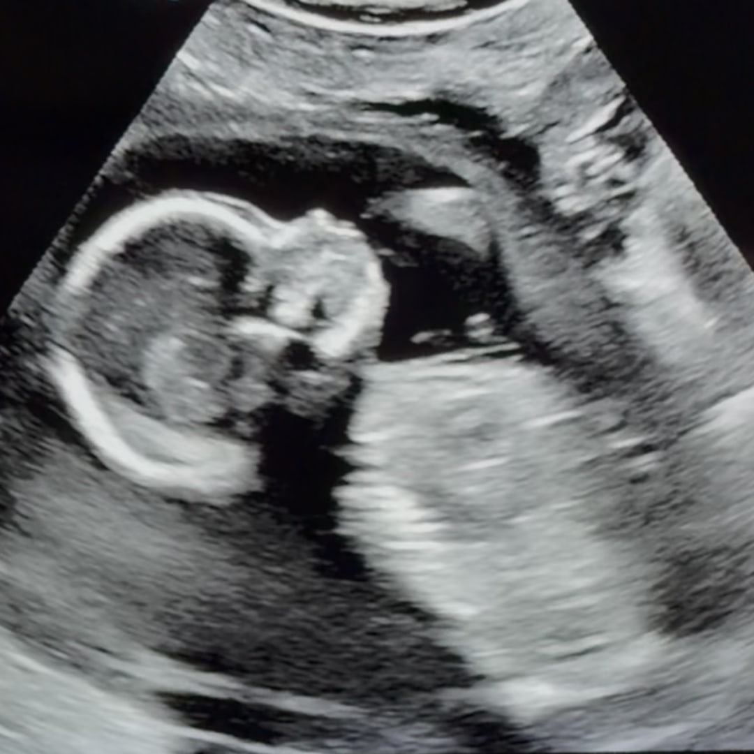 Photo shared by Amanda for their Babylist baby registry.