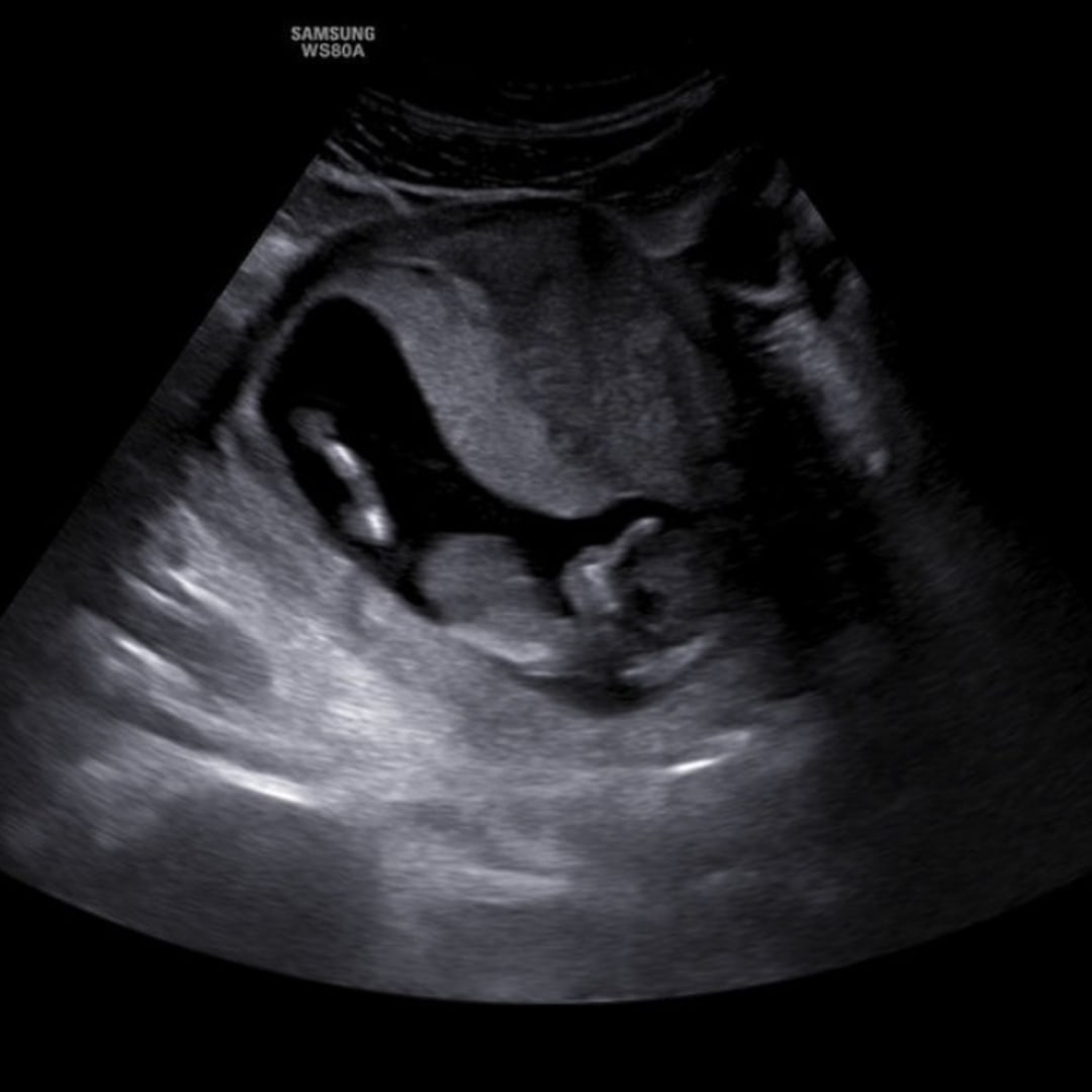 Photo shared by Nicole for their Babylist baby registry.