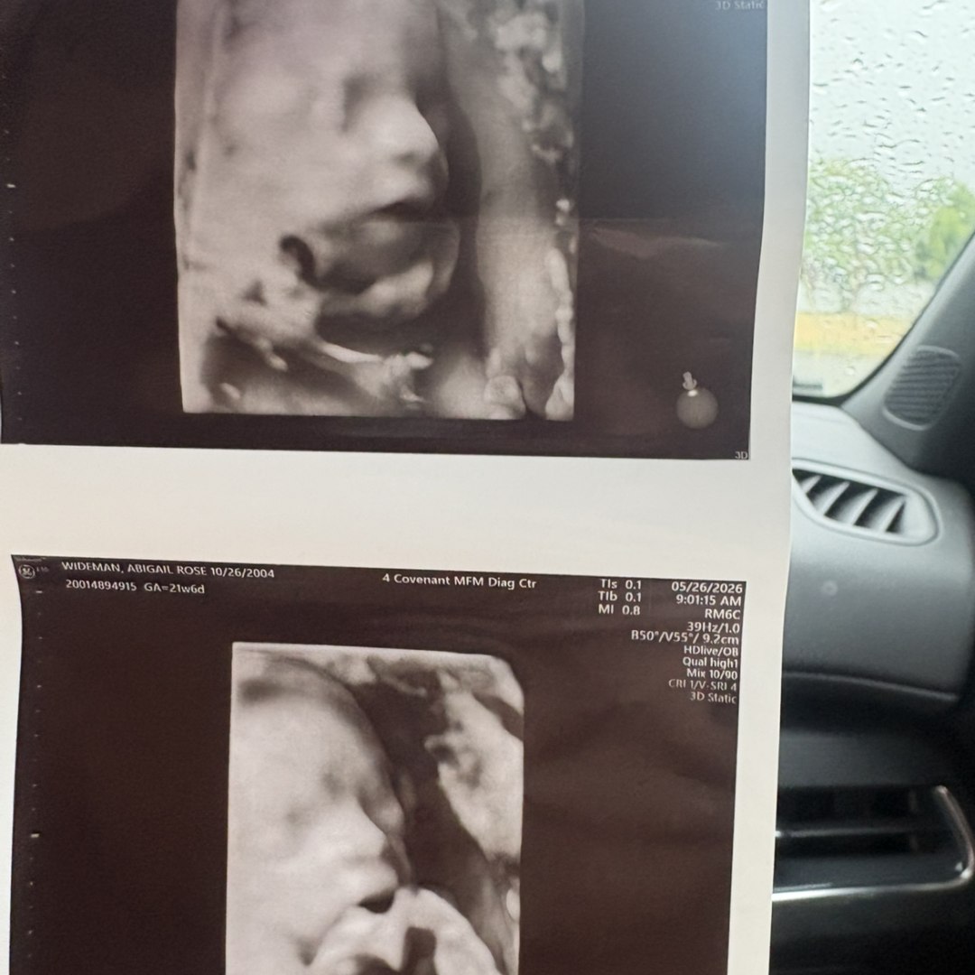 Photo shared by Abby for their Babylist baby registry.
