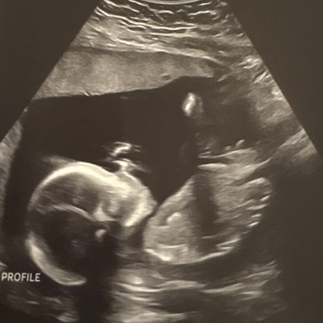 Photo shared by Kynleigh for their Babylist baby registry.