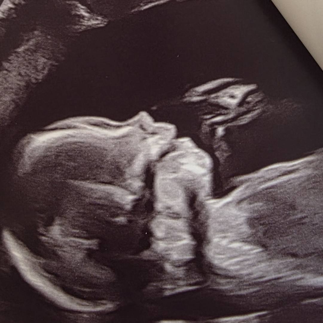 Photo shared by Rachel for their Babylist baby registry.