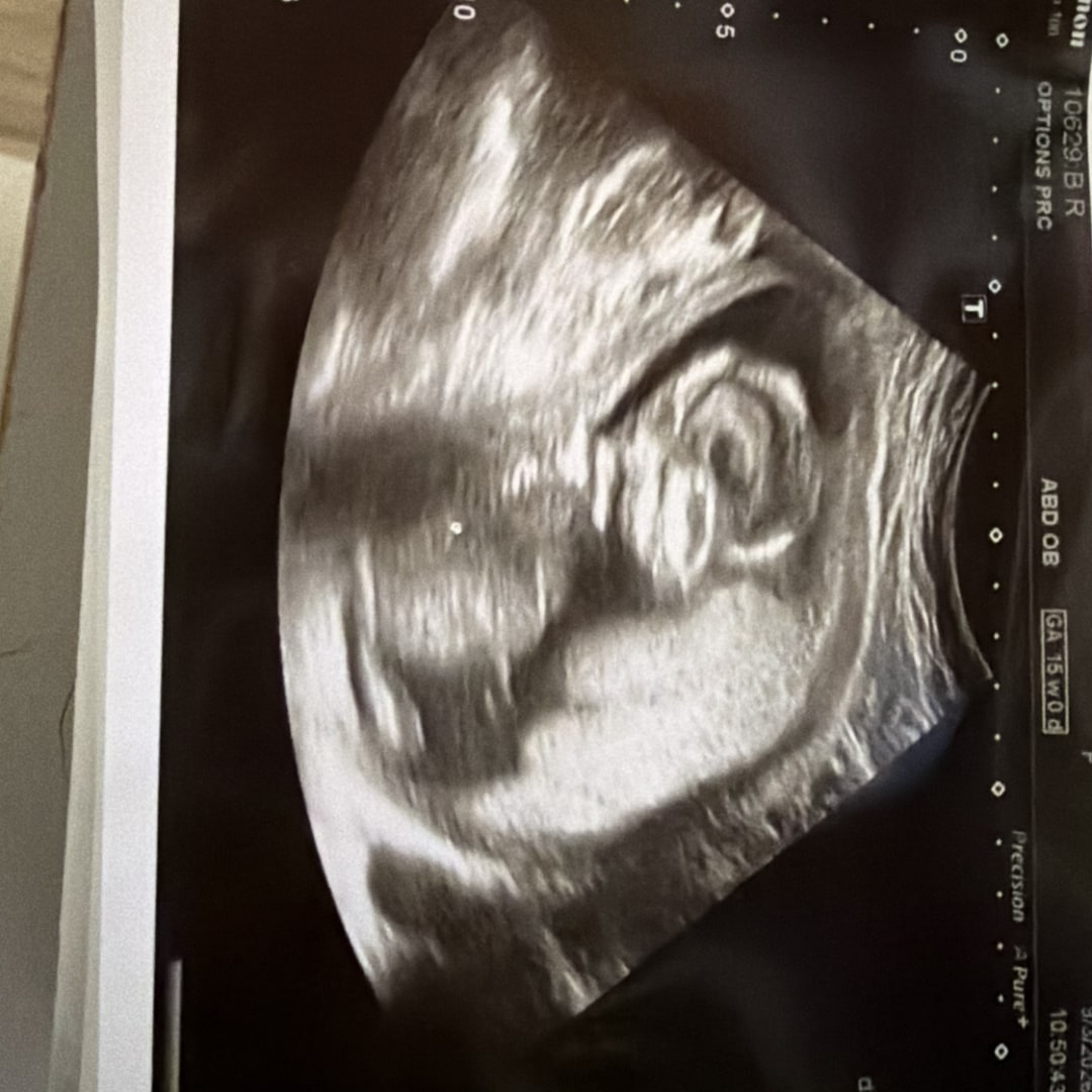 Photo shared by Rachel for their Babylist baby registry.
