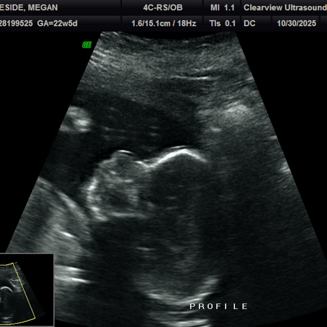 Photo shared by Megan for their Babylist baby registry.