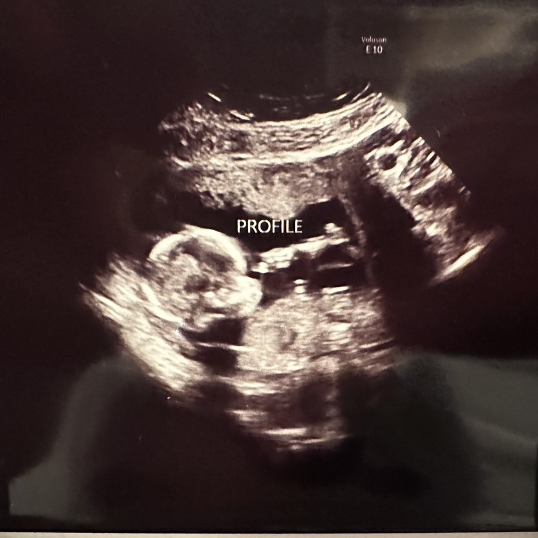 Photo shared by Bailee for their Babylist baby registry.