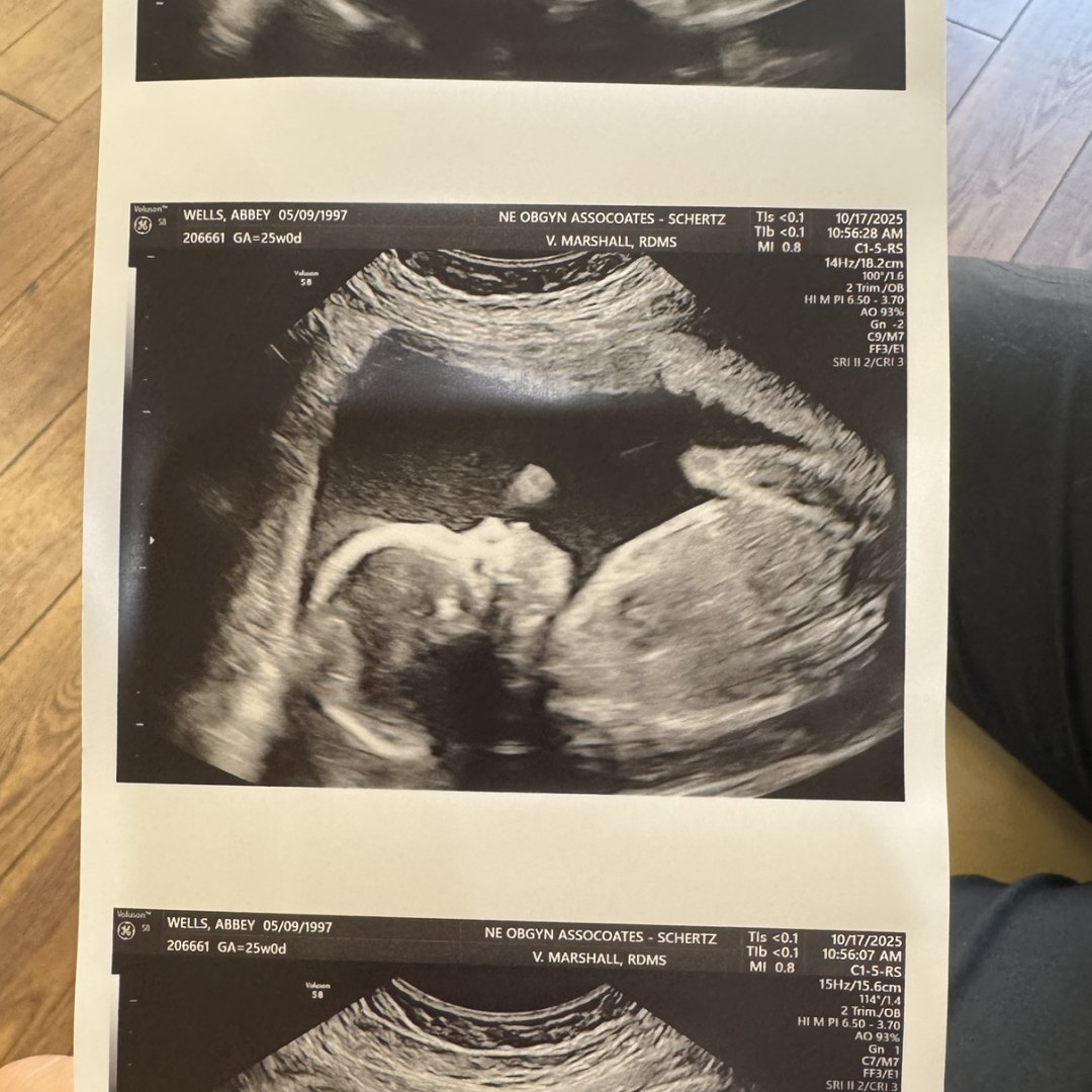 Photo shared by Abbey for their Babylist baby registry.