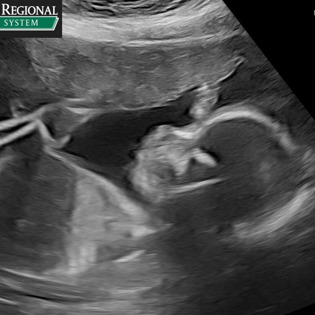 Photo shared by Morgan for their Babylist baby registry.