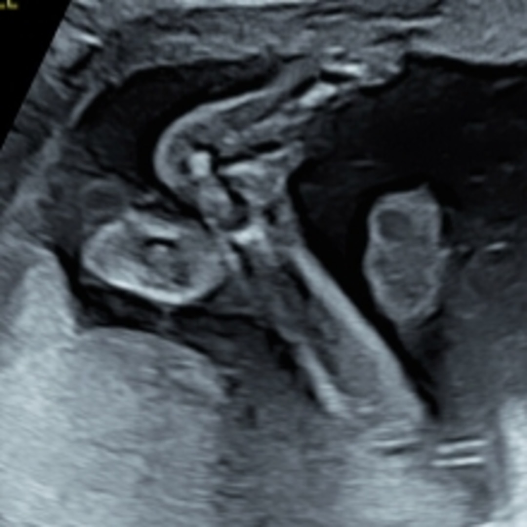 Photo shared by Casey for their Babylist baby registry.