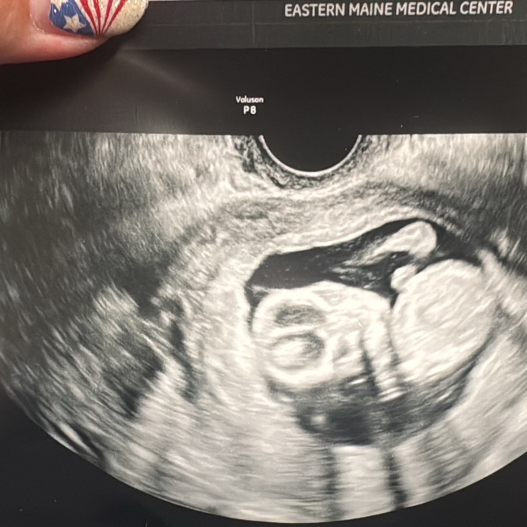 Photo shared by Emmalee for their Babylist baby registry.