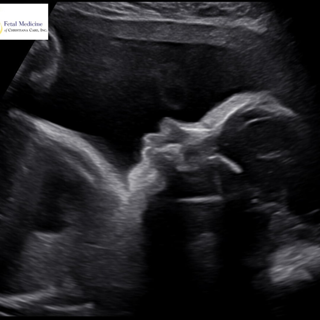 Photo shared by Blair for their Babylist baby registry.