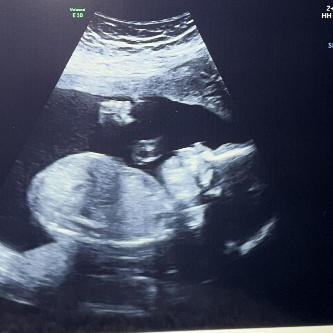 Photo shared by Sigourney for their Babylist baby registry.