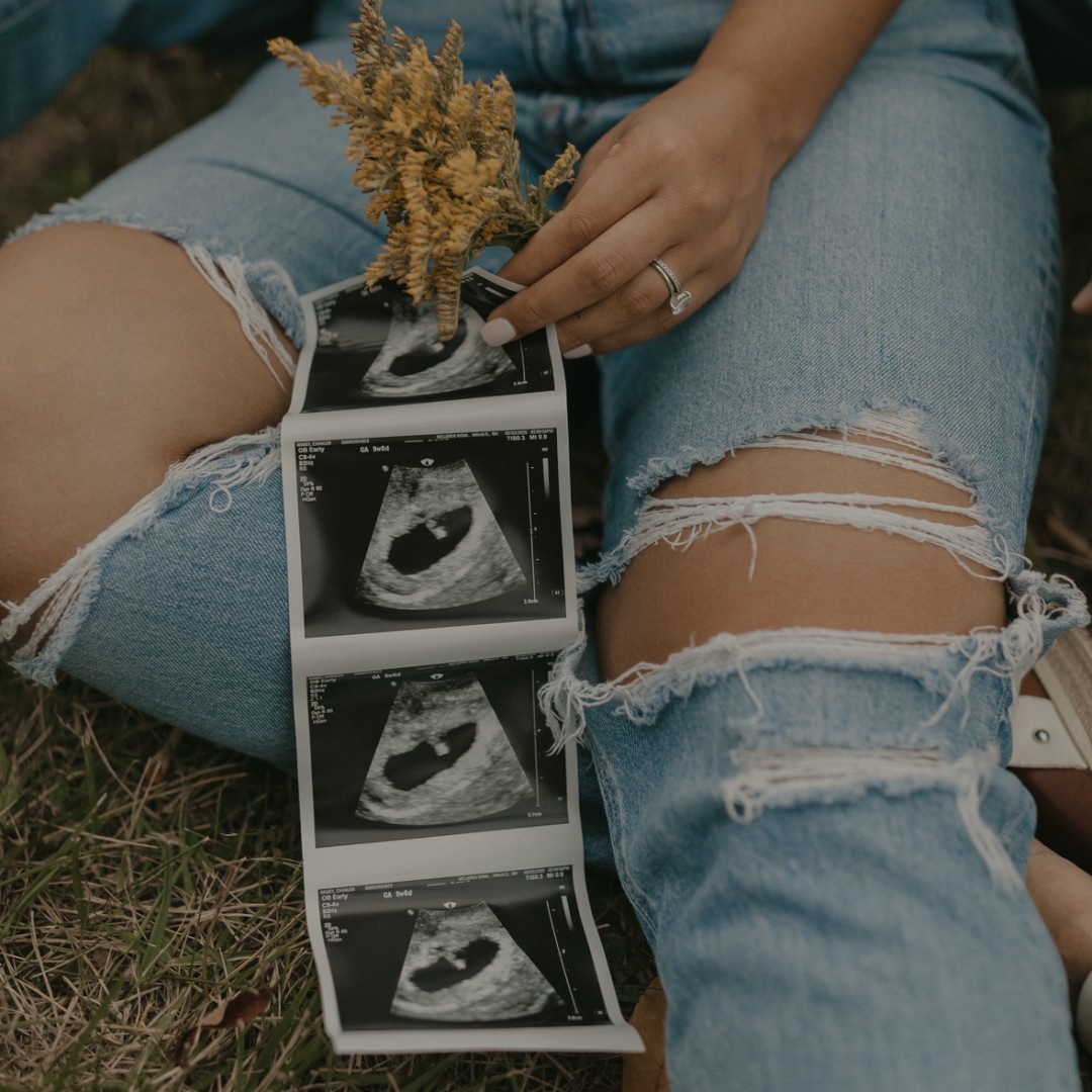 Photo shared by Dawson for their Babylist baby registry.