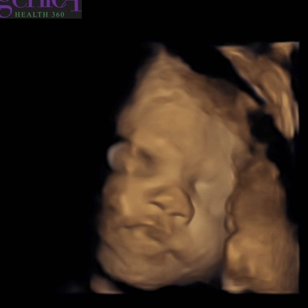 Photo shared by Alexandrea for their Babylist baby registry.