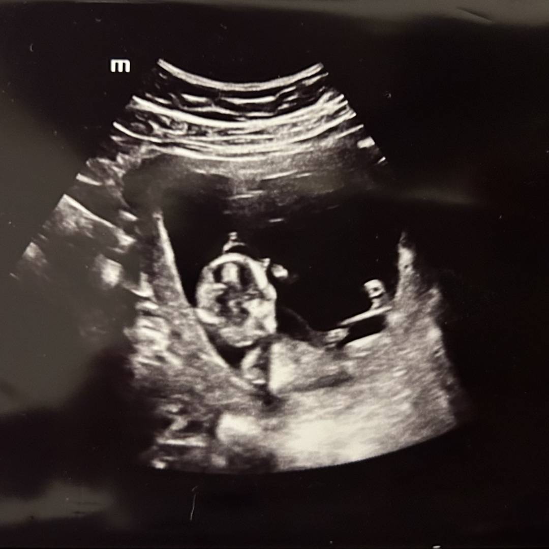 Photo shared by Danielle for their Babylist baby registry.