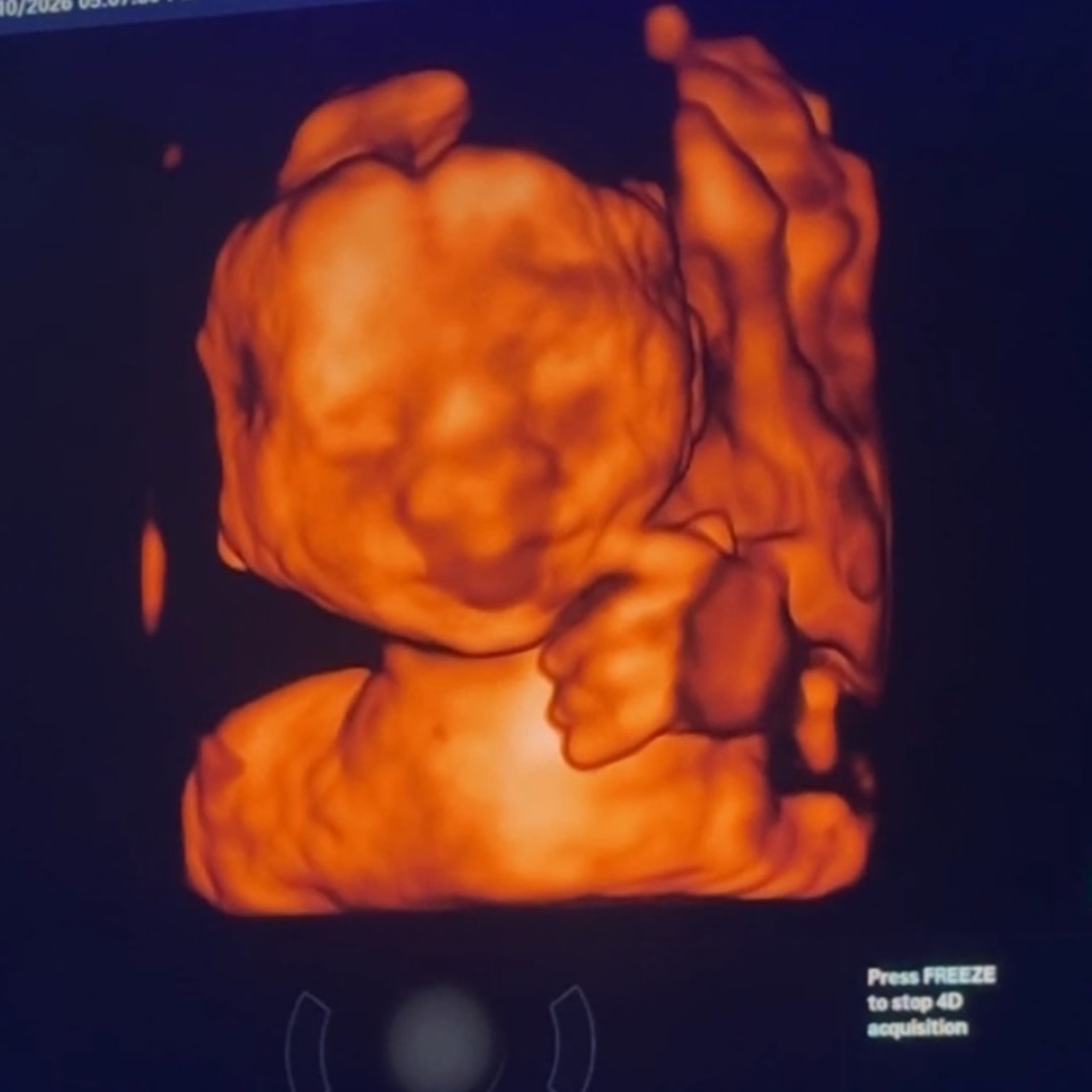 Photo shared by Vania for their Babylist baby registry.