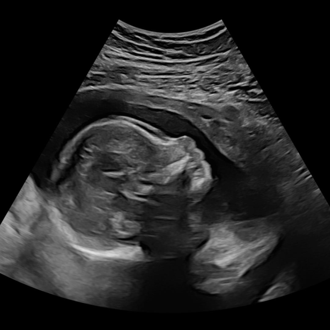 Photo shared by Marissa for their Babylist baby registry.