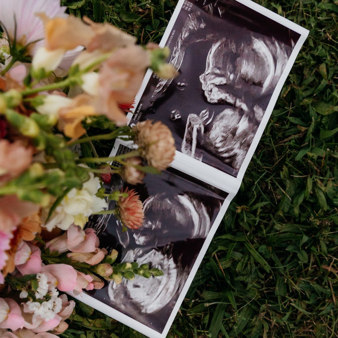 Photo shared by Alison for their Babylist baby registry.