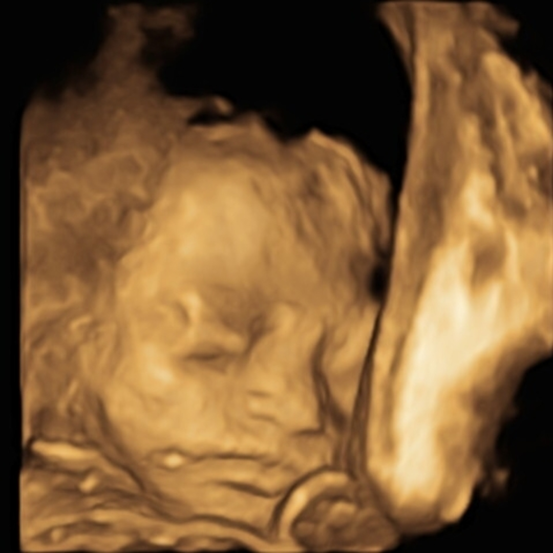 Photo shared by Destiny for their Babylist baby registry.