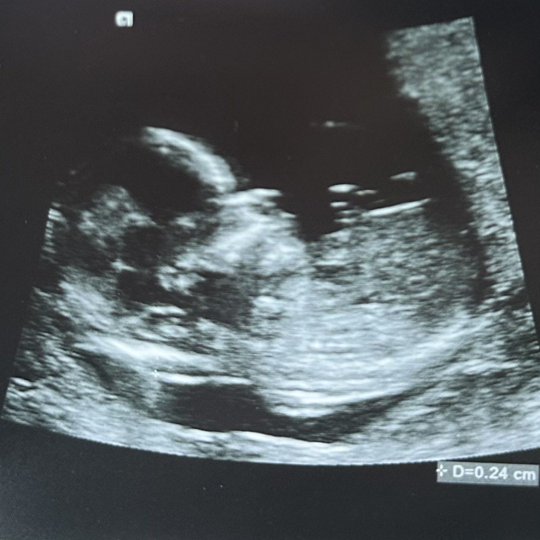 Photo shared by Dellaresse for their Babylist baby registry.