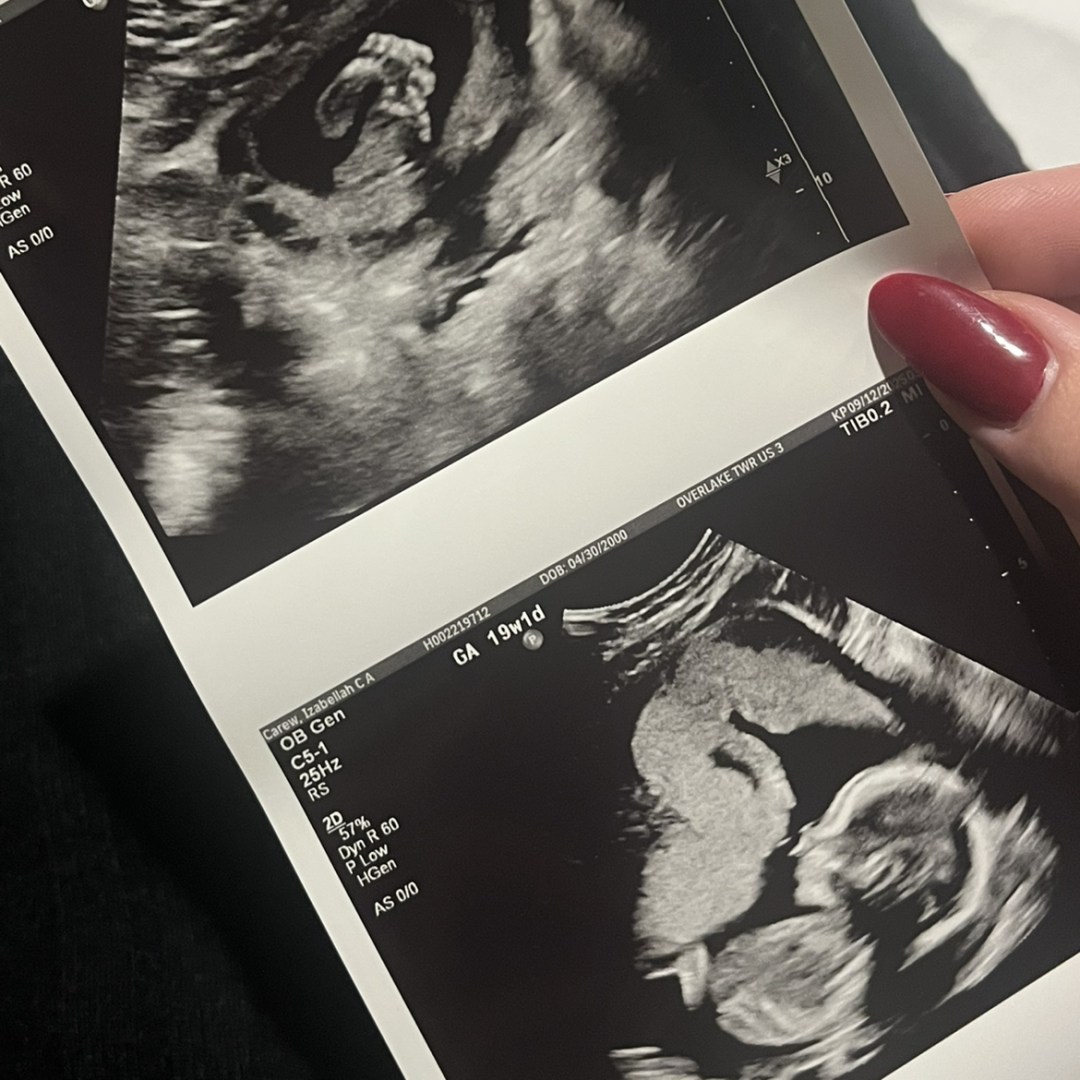 Photo shared by Izabellah for their Babylist baby registry.