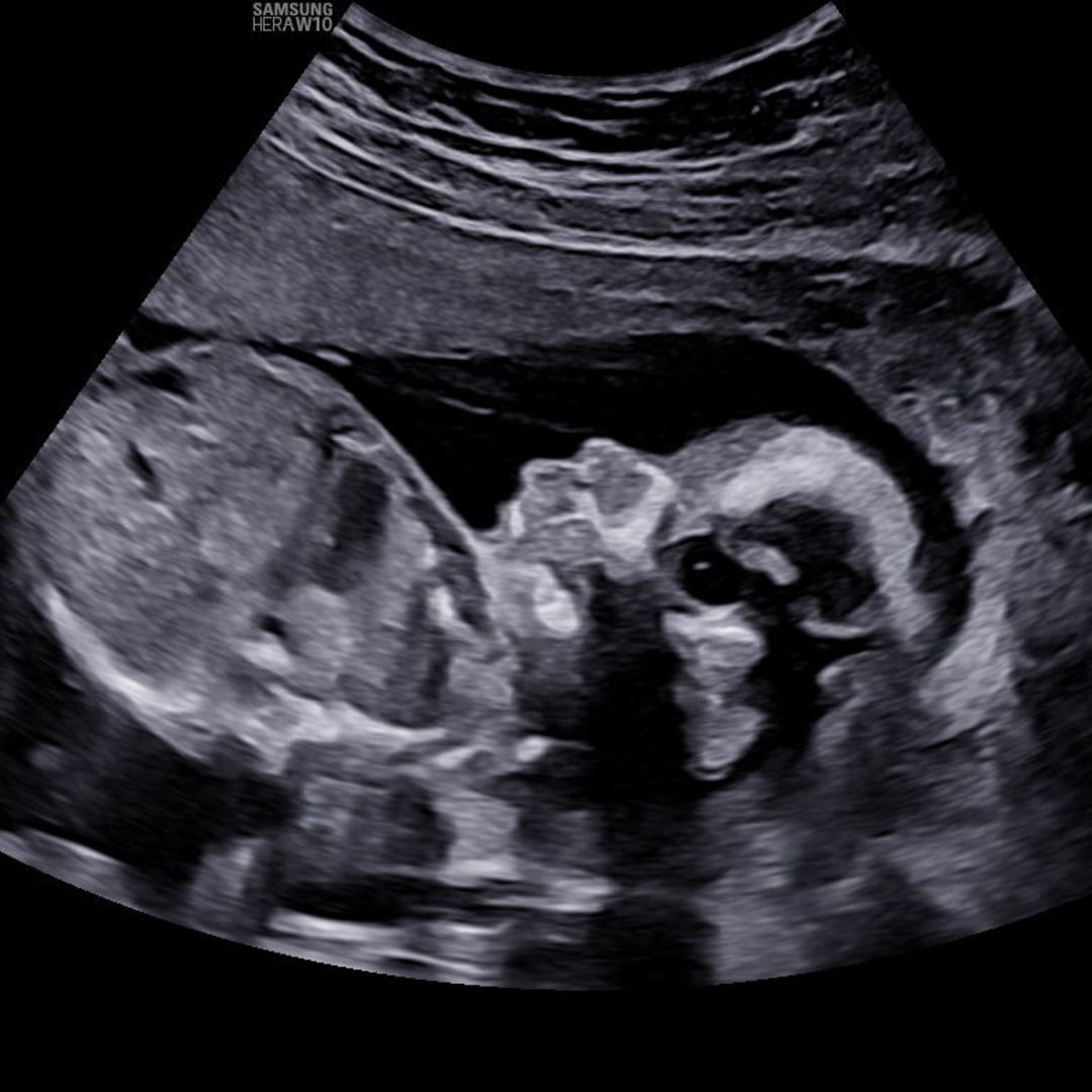 Photo shared by Camila for their Babylist baby registry.