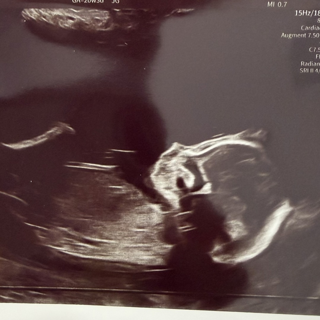 Photo shared by Meghan for their Babylist baby registry.