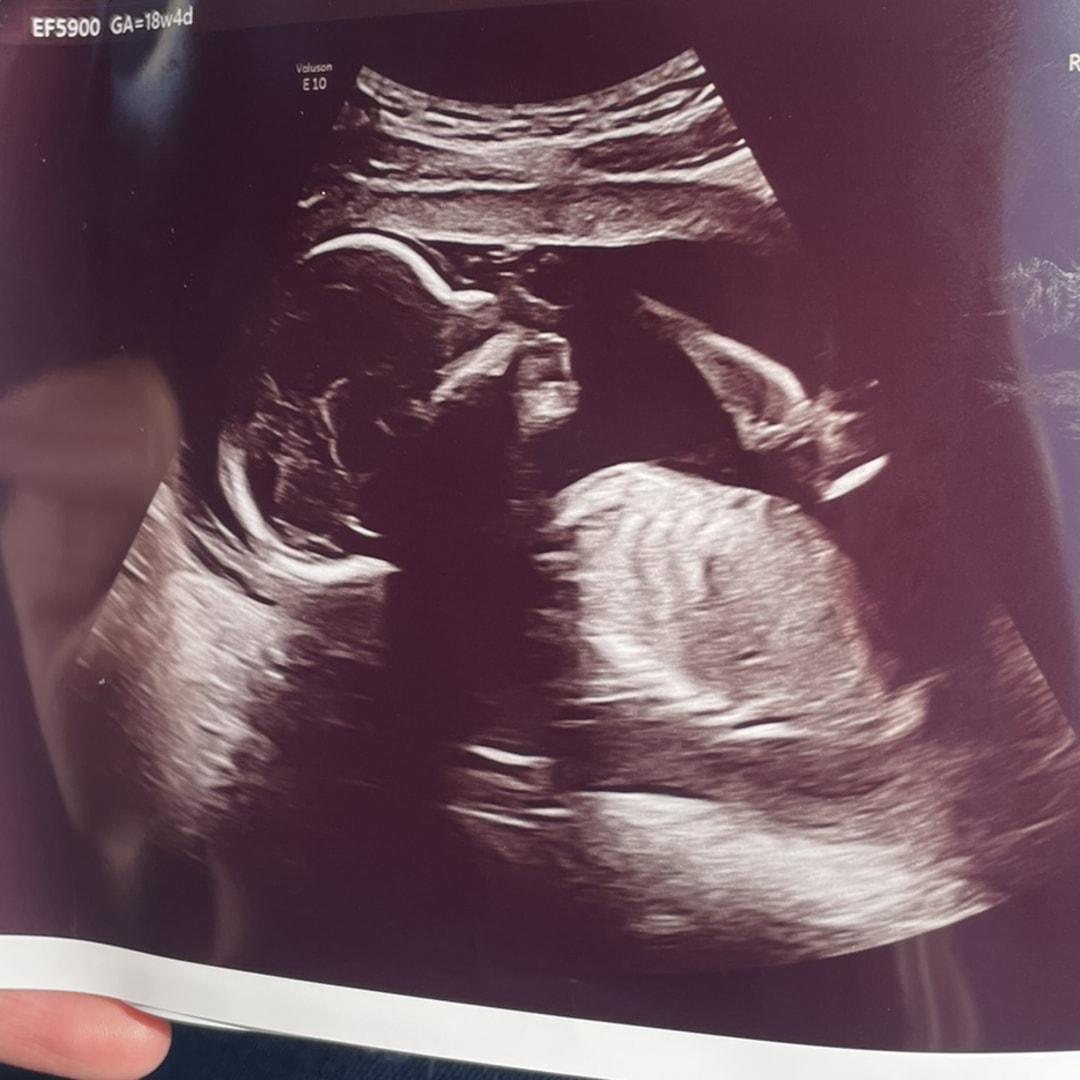 Photo shared by ShaTyra for their Babylist baby registry.