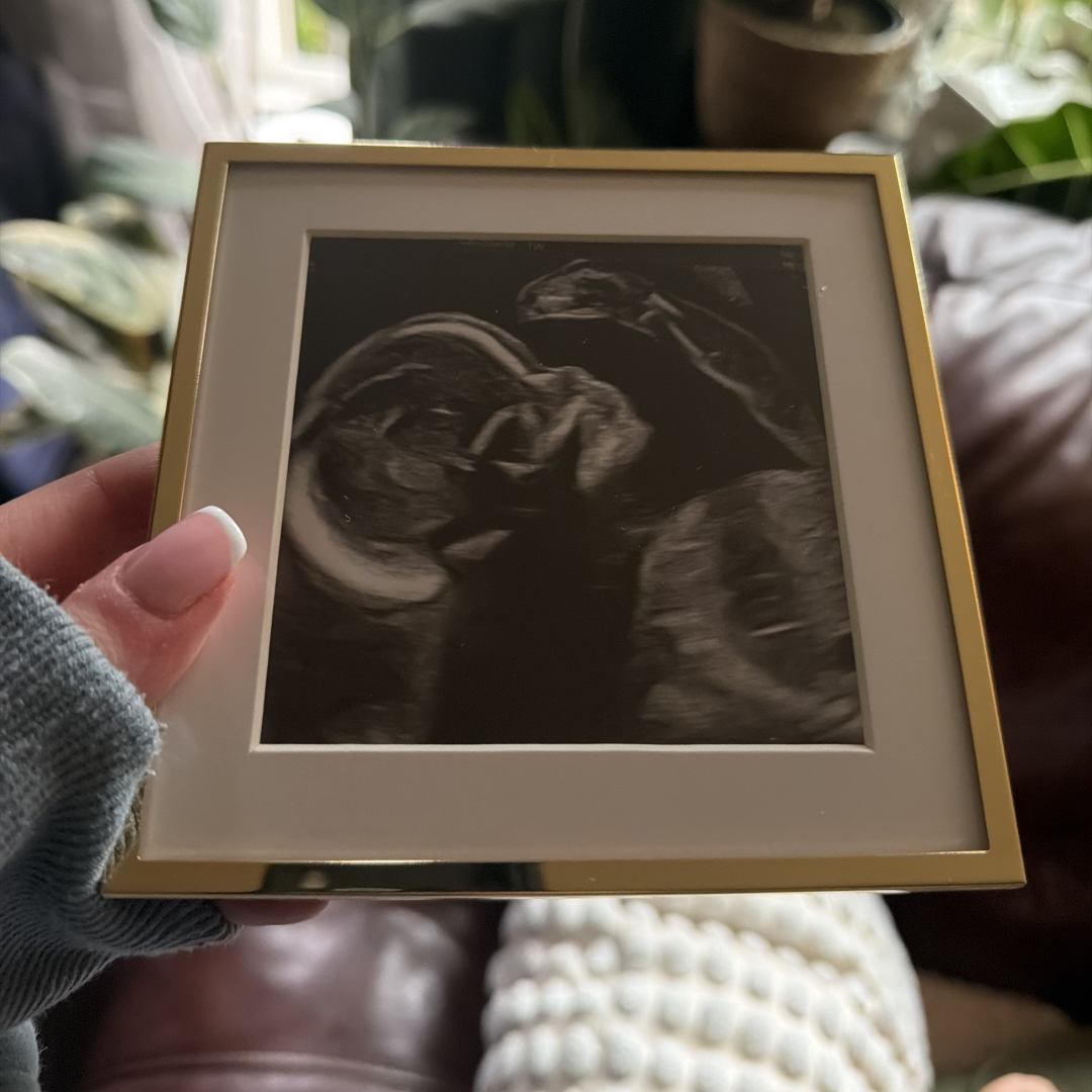 Photo shared by Madeline for their Babylist baby registry.