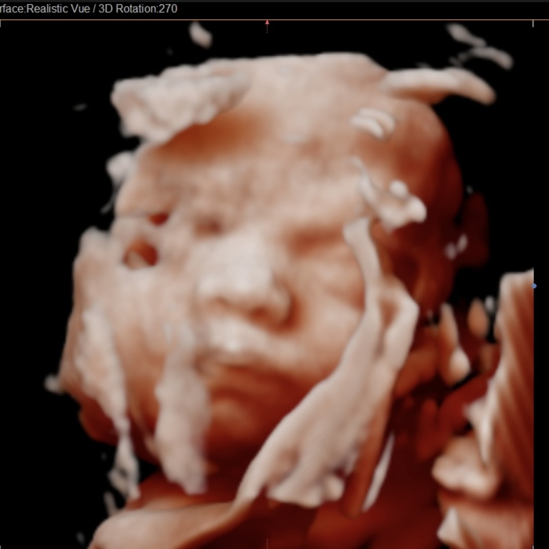 Photo shared by Allie for their Babylist baby registry.