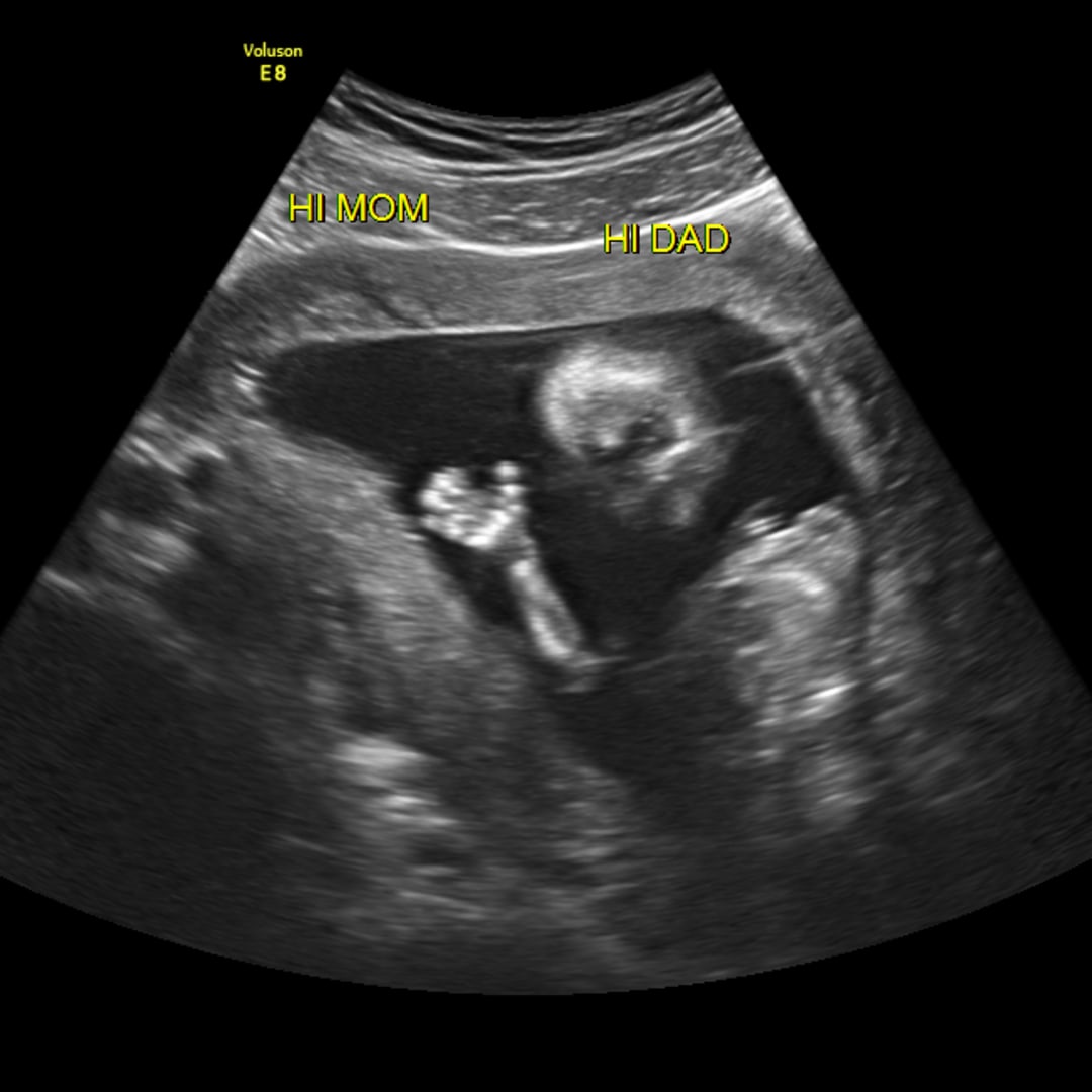 Photo shared by Erin for their Babylist baby registry.