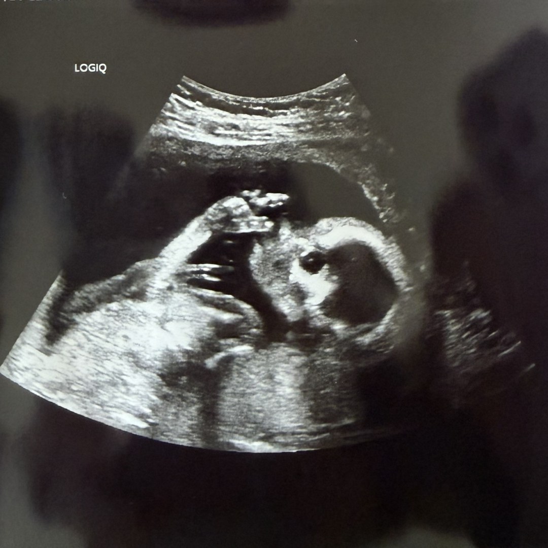 Photo shared by Haley for their Babylist baby registry.