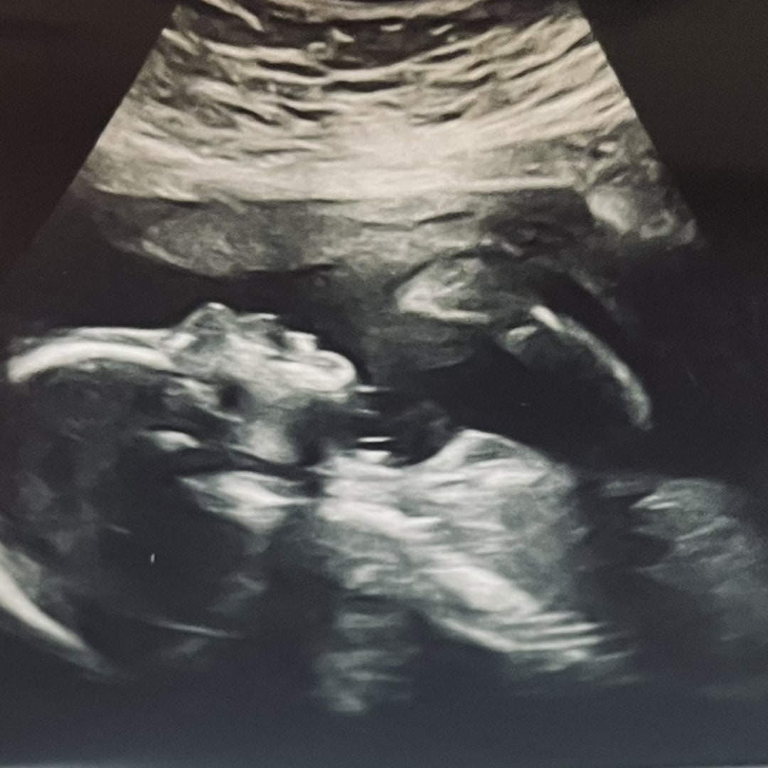 Photo shared by Daphnea for their Babylist baby registry.