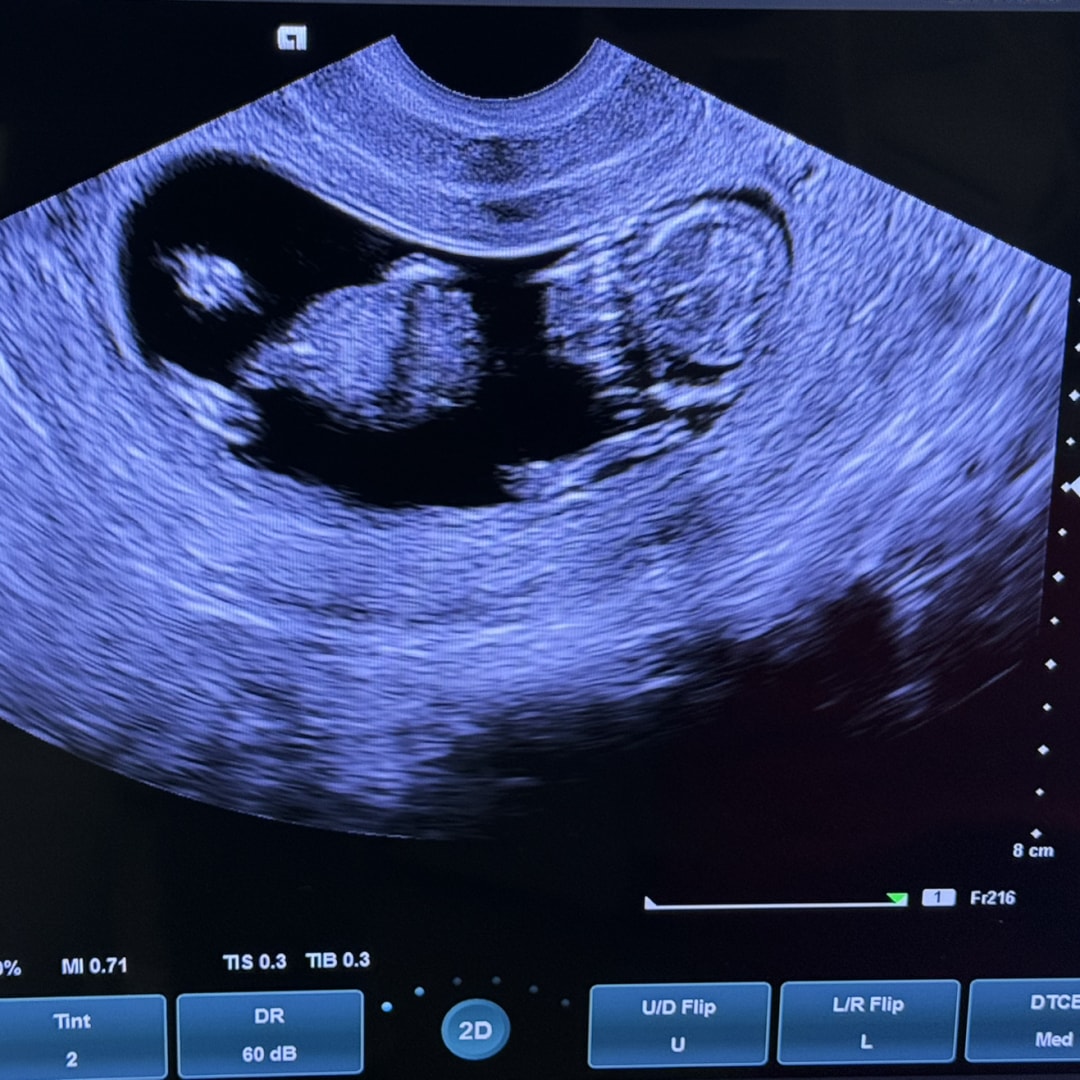 Photo shared by Chris for their Babylist baby registry.