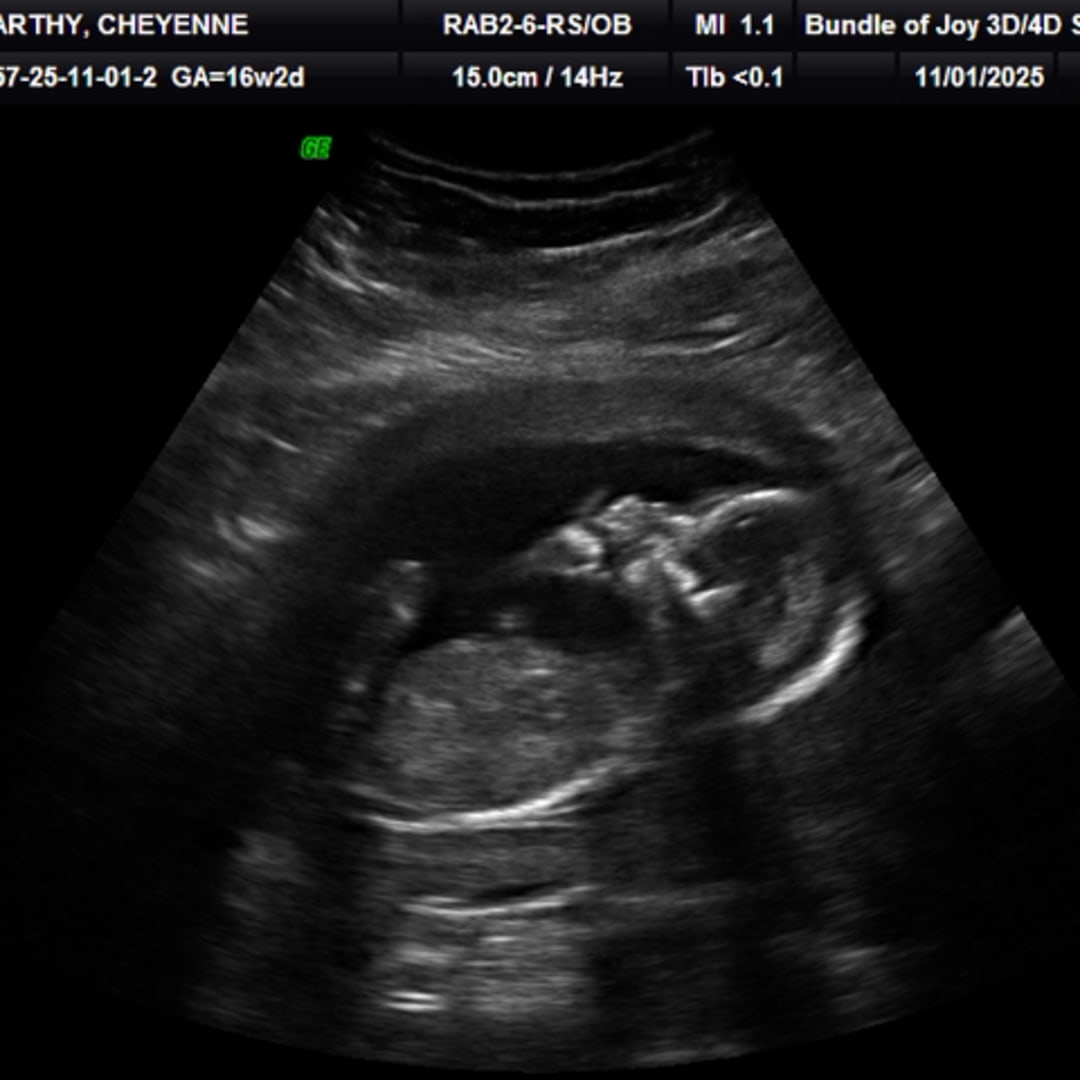 Photo shared by Cheyenne for their Babylist baby registry.