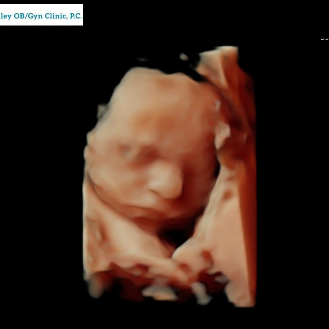 Photo shared by Carly for their Babylist baby registry.