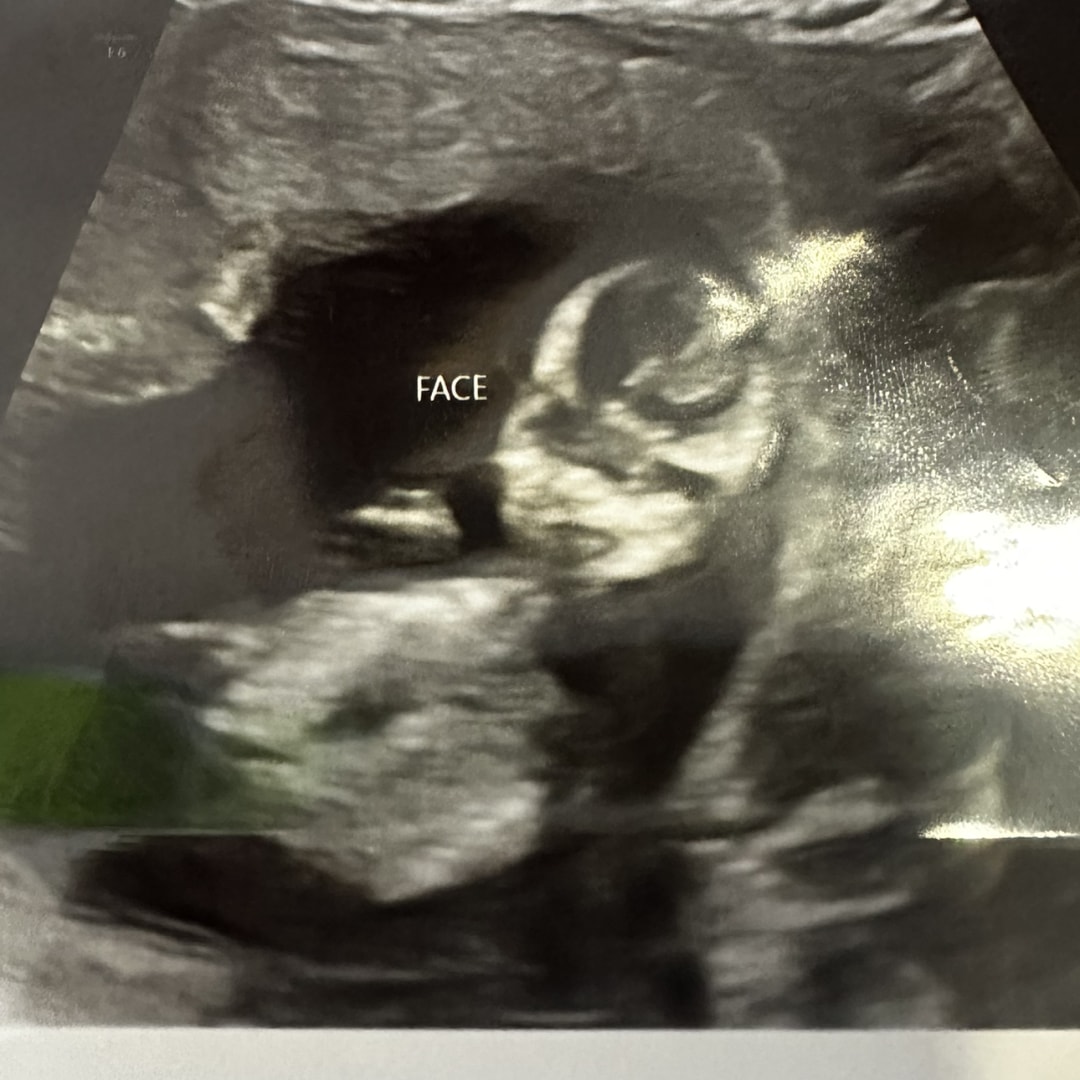 Photo shared by Makenzie for their Babylist baby registry.