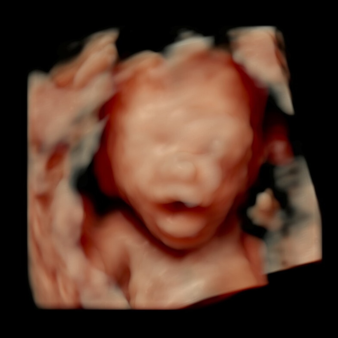 Photo shared by Elvira for their Babylist baby registry.