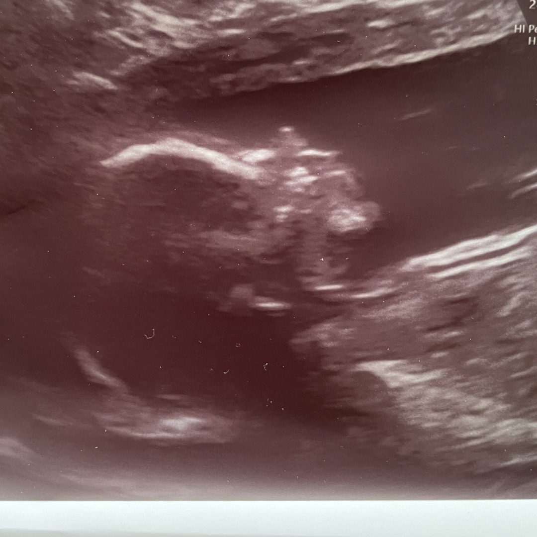 Photo shared by Jessica for their Babylist baby registry.