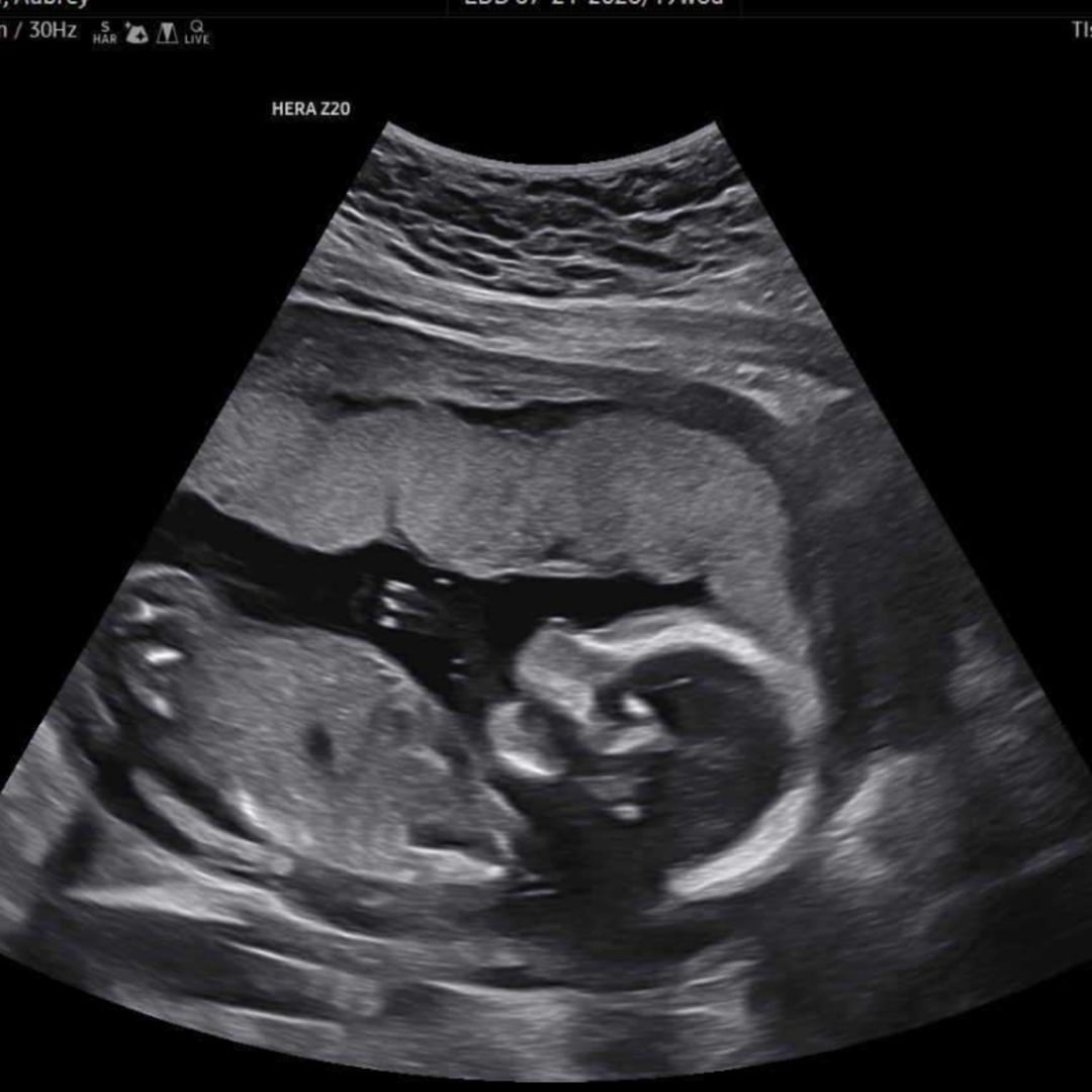 Photo shared by Aubrey for their Babylist baby registry.