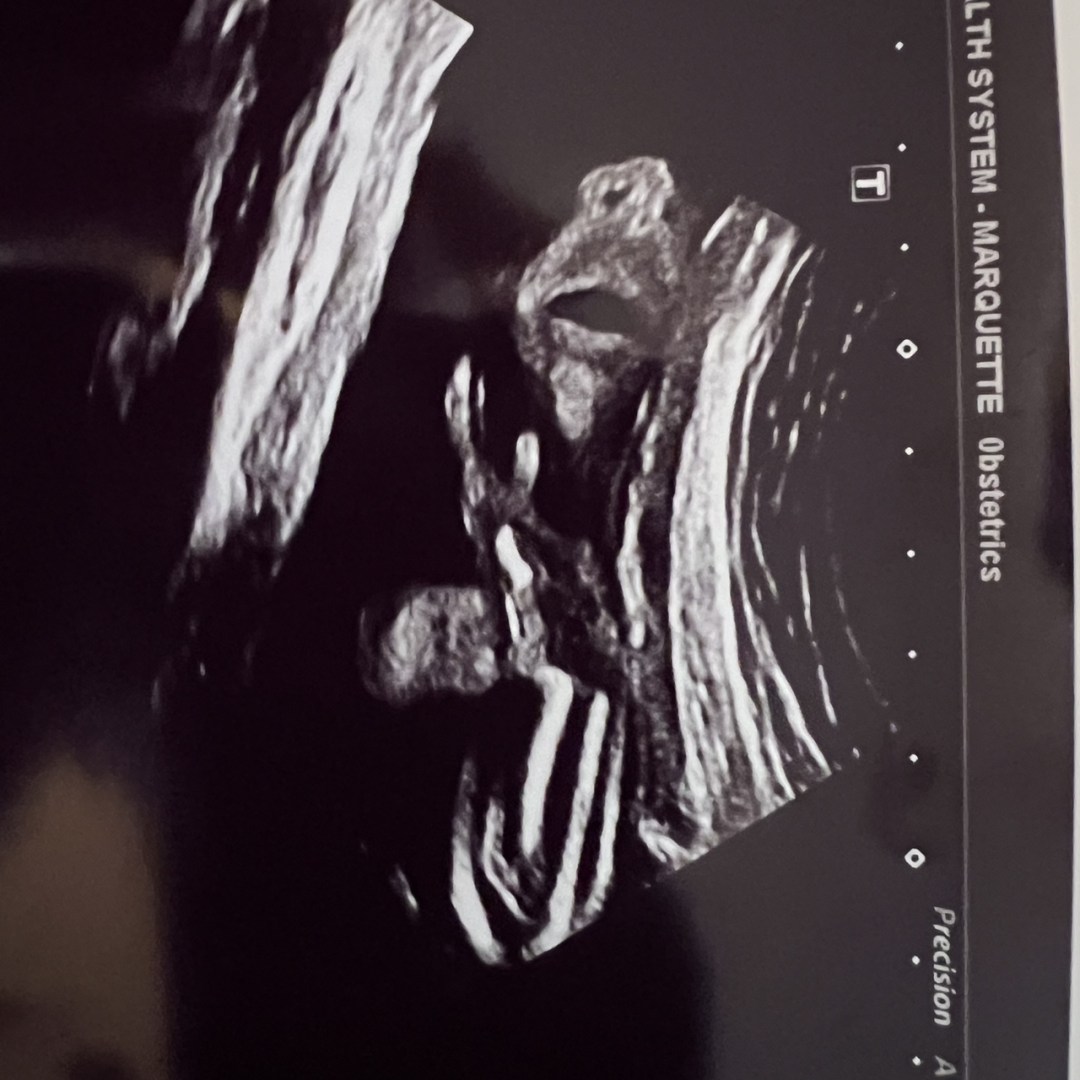 Photo shared by Avah for their Babylist baby registry.