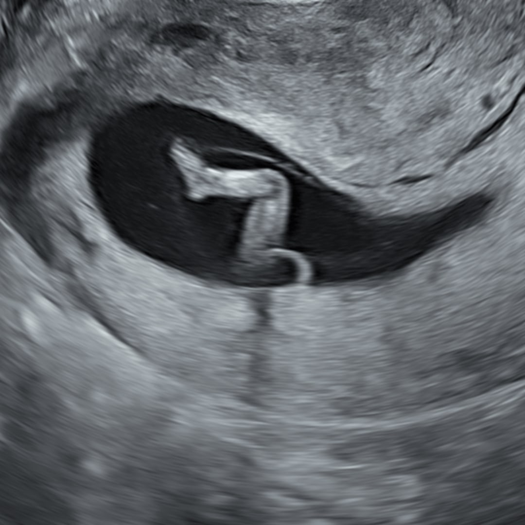 Photo shared by Heather for their Babylist baby registry.