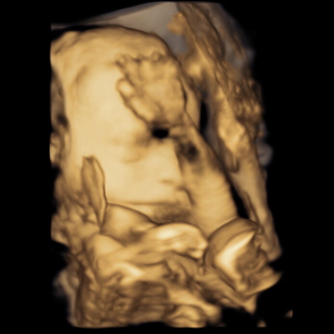 Photo shared by Samrah for their Babylist baby registry.