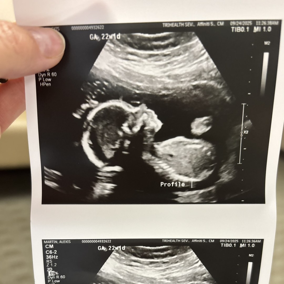 Photo shared by Lexi for their Babylist baby registry.