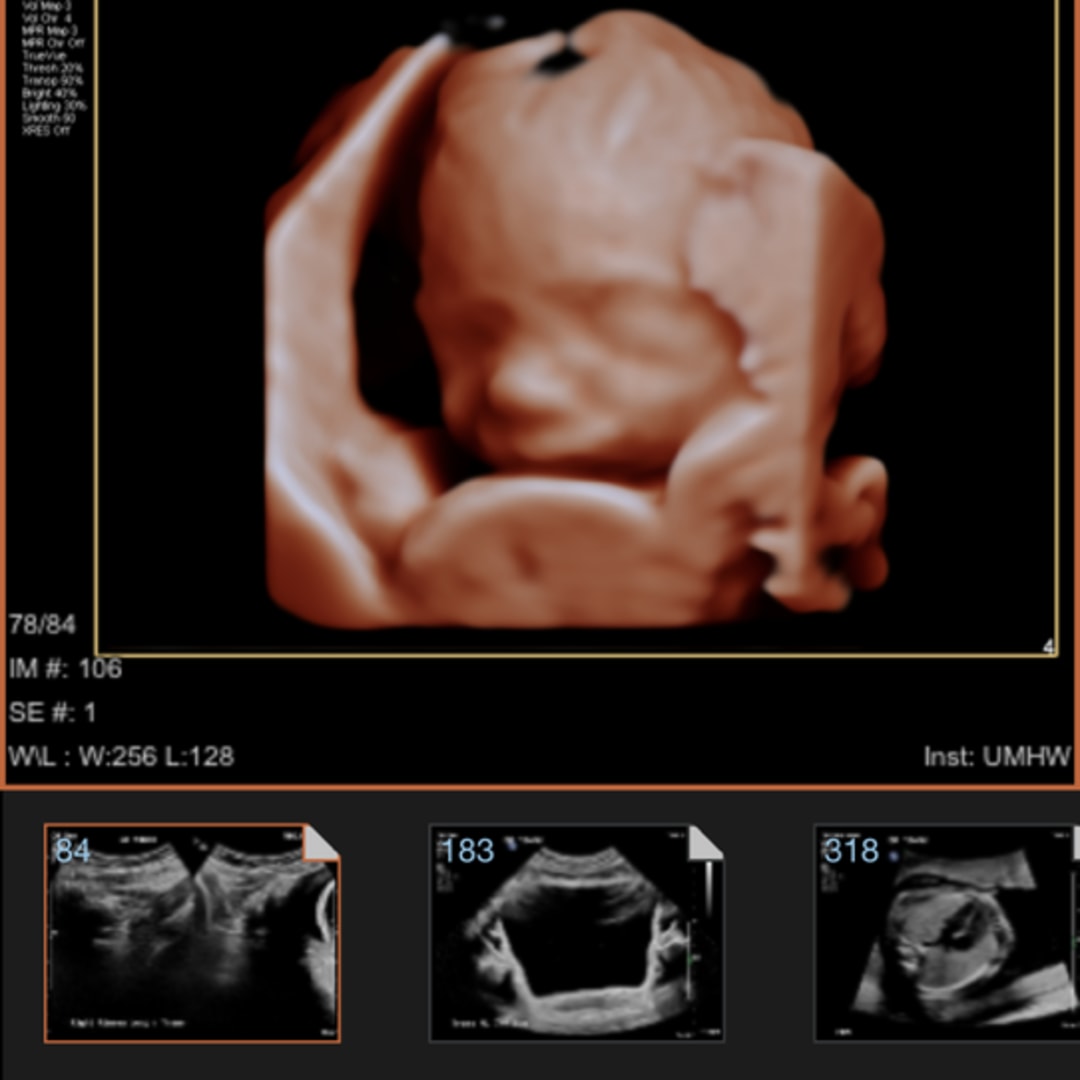 Photo shared by Brooke for their Babylist baby registry.