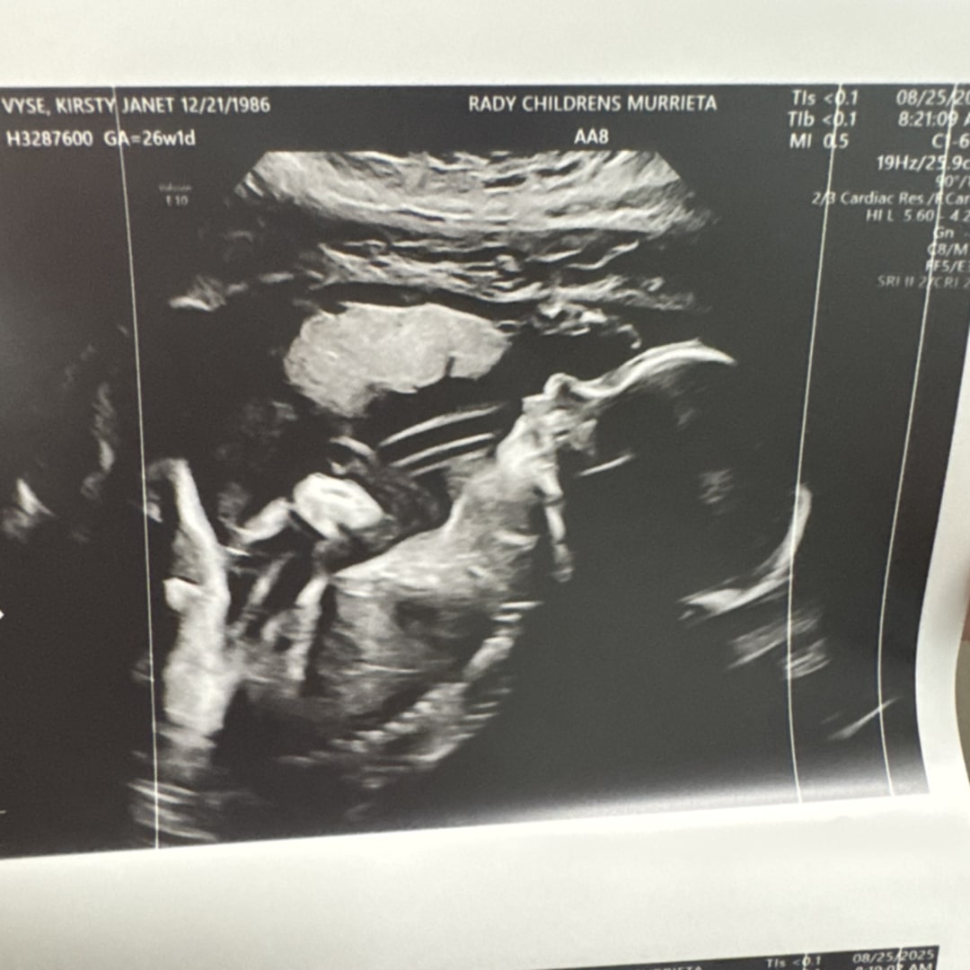 Photo shared by Kirsty for their Babylist baby registry.