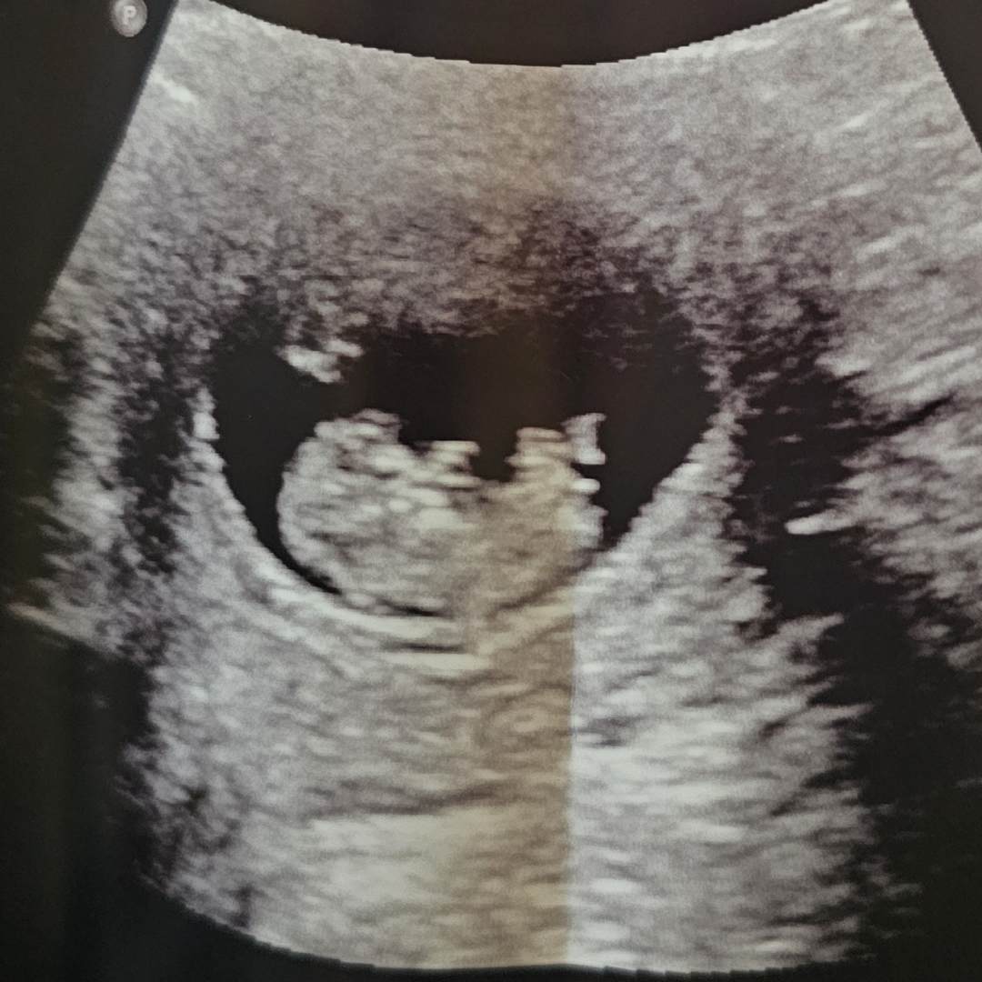 Photo shared by Amanda for their Babylist baby registry.
